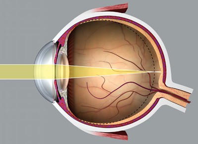 optikusok látásvizsgálattal